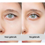 EyePerfection | Double Eyelid Tape for Drooping Eyelids | Unisex