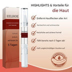 WartOff Skin Spot Remover Painless Natural Formula 1 Get 1 Free