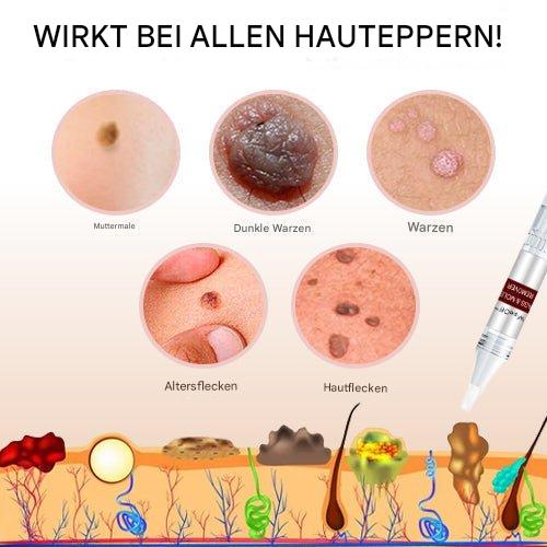 WartOff Skin Spot Remover Painless Natural Formula 1 Get 1 Free