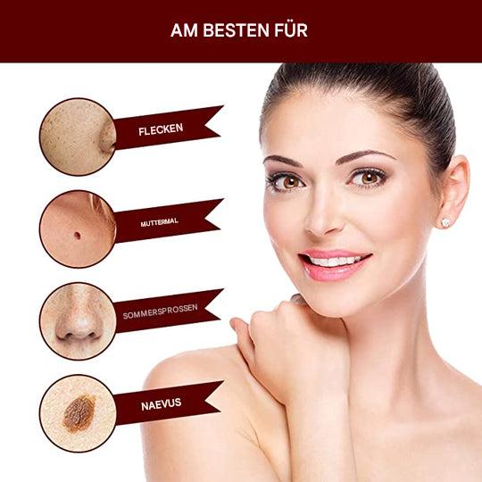 WartOff Skin Spot Remover Painless Natural Formula 1 Get 1 Free