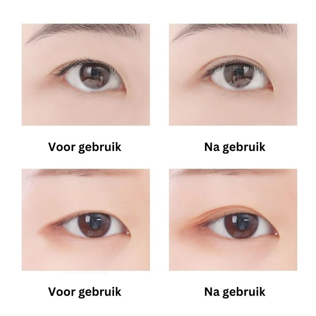 EyePerfection | Double Eyelid Tape for Drooping Eyelids | Unisex
