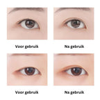 EyePerfection | Double Eyelid Tape for Drooping Eyelids | Unisex